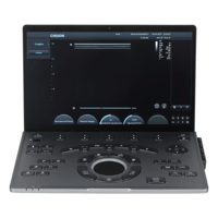 Système d'échographie portable Chison SonoAir 70