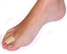 Protections et modèles de silicone et gel