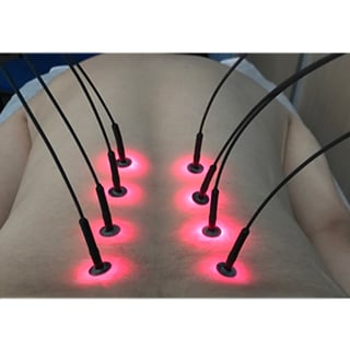 Système d'aiguille lumineuse Light Needle 8 fibres : Convertit 1 laser en 8 points de sortie simultanés