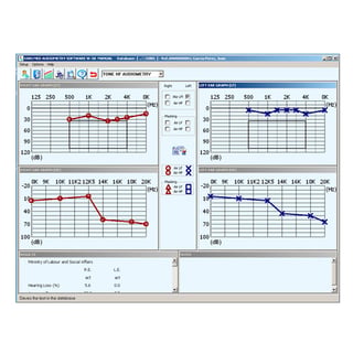 Logiciel Sibelmed W5O pour audiomètre Sibelmed 400