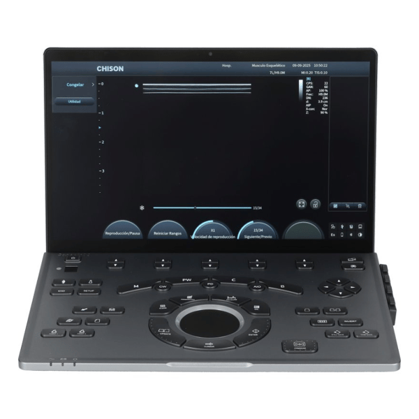 Système d'échographie portable Chison SonoAir 70