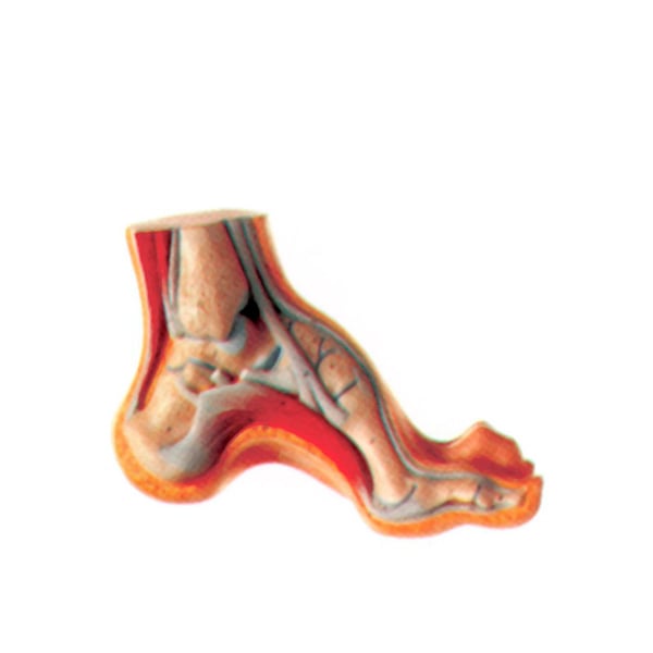 Exposition du pied creux