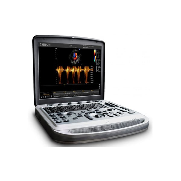 Échographe portable Chison Sonobook 8 avec plusieurs sondes - D'OCCASION