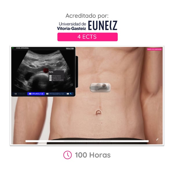 WAZO CAMPUS : Cours en ligne d’échographie abdominale. Certificat universitaire officiel délivré par l’Université de Vitoria-Gasteiz (EUNEIZ).