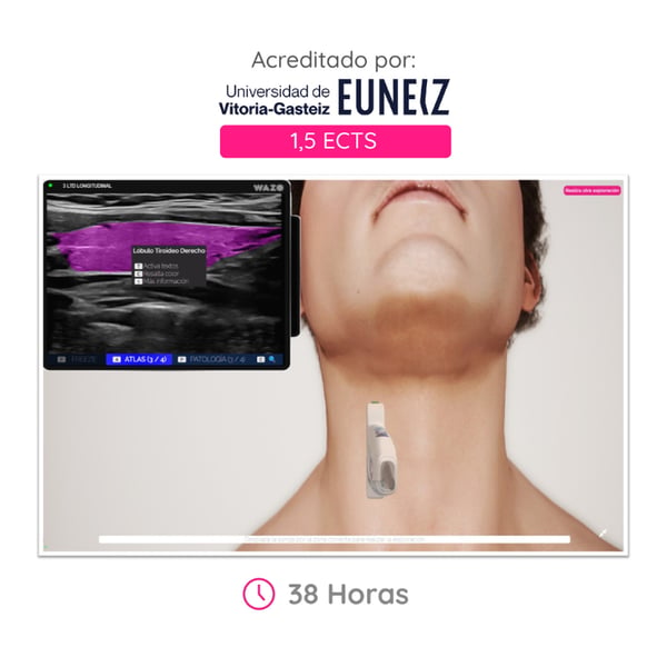 WAZO CAMPUS : Cours en ligne d’échographie cervicale et thyroïdienne. Certificat universitaire officiel délivré par l’Université de Vitoria-Gasteiz (EUNEIZ).