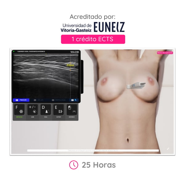WAZO CAMPUS : Cours en ligne d’échographie mammaire. Certificat universitaire officiel délivré par l’Université de Vitoria-Gasteiz (EUNEIZ).