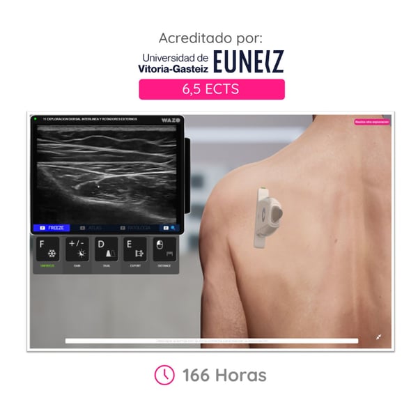 WAZO CAMPUS : Cours en ligne sur le système musculo-squelettique. Certificat universitaire officiel délivré par l’Université de Vitoria-Gasteiz (EUNEIZ).