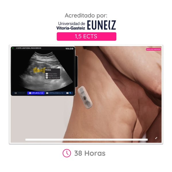 WAZO CAMPUS : Cours en ligne d’échographie mammaire. Certificat universitaire officiel délivré par l’Université de Vitoria-Gasteiz (EUNEIZ).