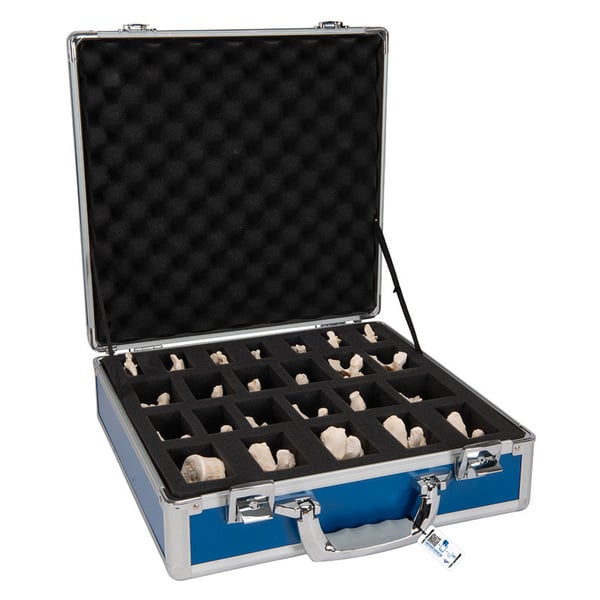 Lot de 24 vertèbres BONElike