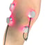 LaserPatch 650 : système modulaire pour la thérapie laser et l’acupuncture laser LaserPatch 650 : système modulaire pour la thérapie laser et l’acupuncture laser