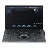 Système d'échographie portable Chison SonoAir 70 Système d'échographie portable Chison SonoAir 70