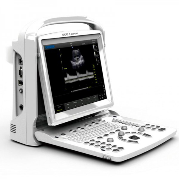 Échographe portable Chison ECO3 Expert Échographe portable Chison ECO3 Expert