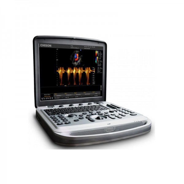 Échographe portable Chison Sonobook8