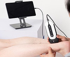 Appareils à ultrasons Chison Sonoeye Appareils à ultrasons Chison Sonoeye