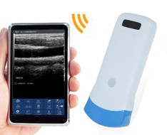 SonoStar Sonographs SonoStar Sonographs