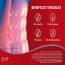 Thermacare genou : patchs thermiques thérapeutiques pour les douleurs du genou (deux unités) Thermacare genou : patchs thermiques thérapeutiques pour les douleurs du genou (deux unités)