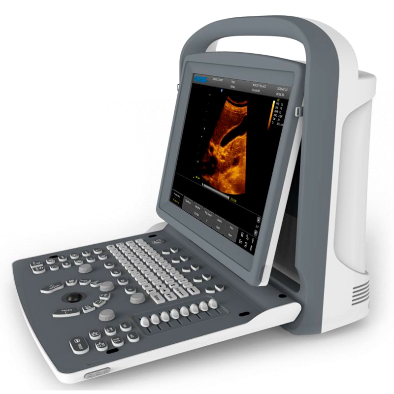 Hc-A010 chariot médical à ultrasons Echographie scanner/appareil numérique  de l'échographie - Chine L'échographie scanner, appareil à échographie